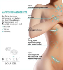 Revée Scar Gel, Gel topic pentru cicatrici Naty Shop