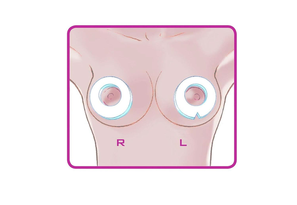 ELANEE Brust-Ringe, Schutz Der Brustwarze Bh-Kontakt Durch Hohllagerung, Ideal Bei Wunden, Entzündeten Brustwarzen Durch Stillen, 10 Stück (222-00) Kiegészítők Élelmiszerek és szoptatás Bebe Naty Shop