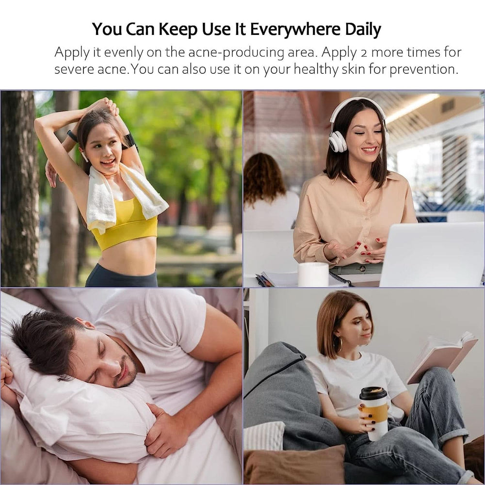 Cremă împotriva acneei, 100 ml Cosmetice si Infrumusetare Naty Shop