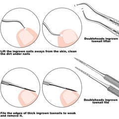 7-Teiliges Set Mit Feilen Und Hebern Für Eingewachsene Zehennägel, Set Aus Edelstahl Zum Entfernen Eingewachsener Zehennägel, Nagelreiniger Für Die Unternagelpflege, Pediküre-Werkzeuge